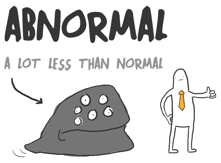 Abnormal Font | dafont.com